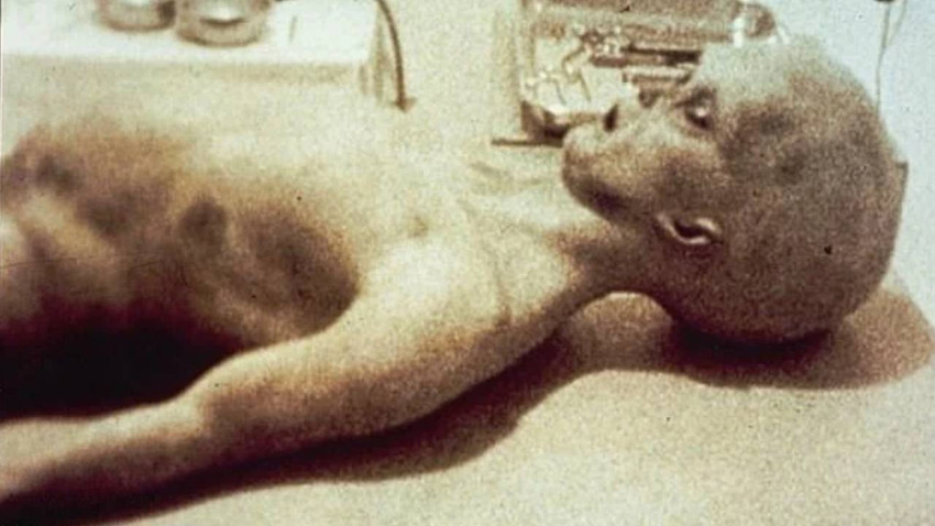 ‘Uzaylı Otopsisi’ Yalanı Yıllar Sonra Ortaya Çıktı: Dünyayı Kandıran Görüntü İçin İtiraf Geldi.