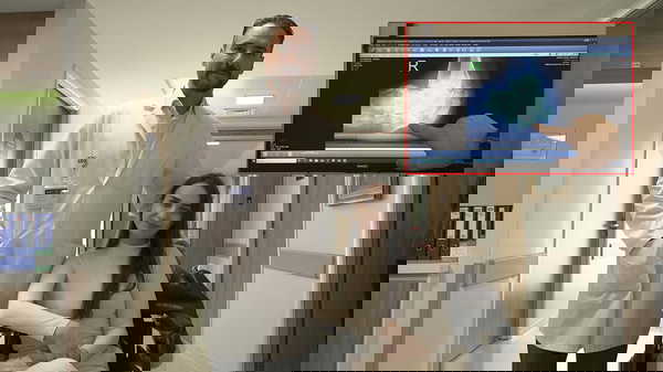 Sırbistan’da “Ayağın Kesilecek” Dediler, Türkiye’de Yeniden Sağlığına Kavuştu