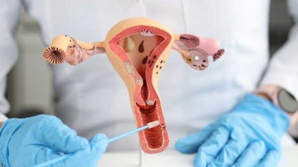 Organları Tehdit Eden Gizli Tehlike: Çikolata Kisti Sadece Jinekolojik Bir Sorun Değil!