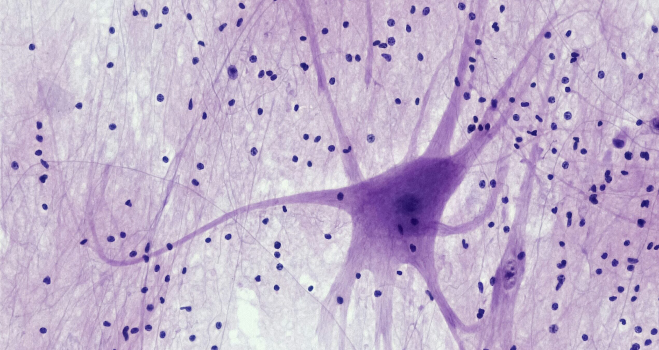 Biyolojik Bilgisayar: DOOM Oynadılar