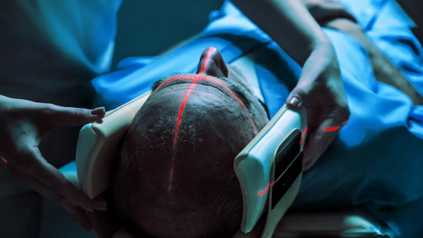 Tıpta “yapay zeka” depremi: Radyologların devri kapanıyor mu?