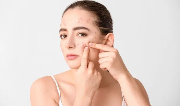 Cildinizi kendi ellerinizle sabote etmeyin: Akneye yol açan 10 sinsi bakım ve makyaj hatası!