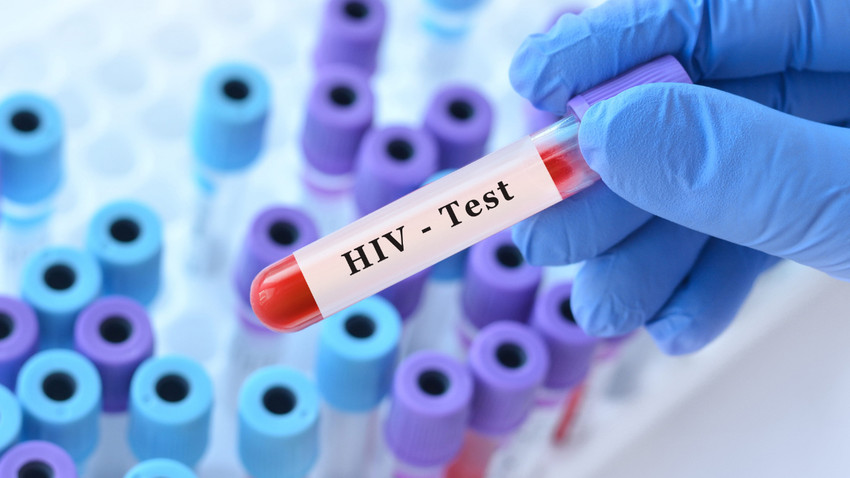 Tıp tarihinde yeni bir zafer: Kemik iliği nakli ile HIV’den tamamen kurtuldu!