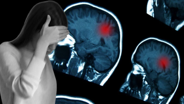 Erken Teşhisin Önemi: Şiddetli Baş Ağrılarında Dikkat Edilmesi Gerekenler