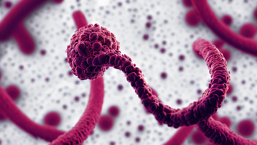 Uzmanından Ebola Uyarısı: Erken Belirtiler Gribe Benziyor